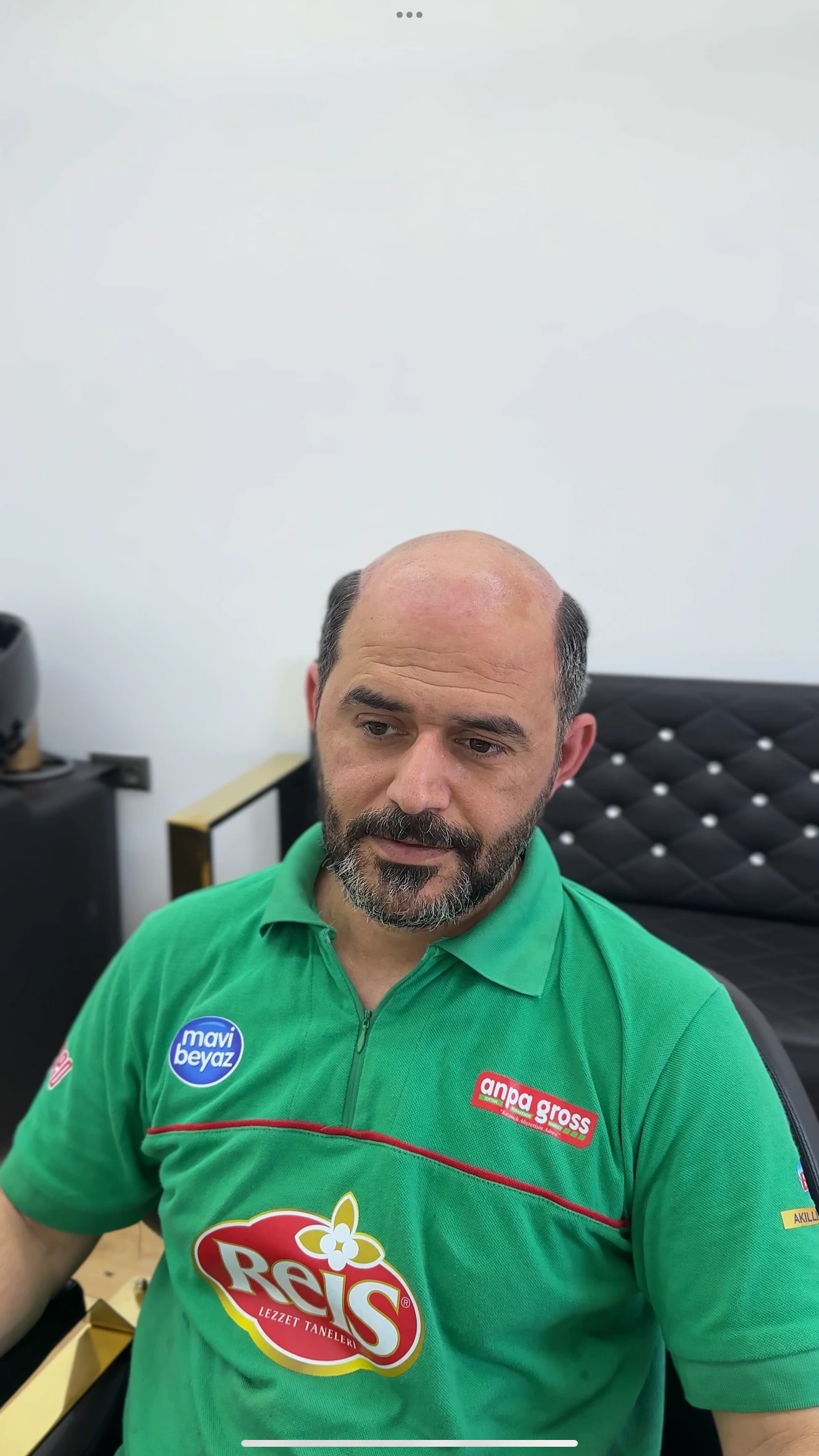 Değişim 11: Öncesi