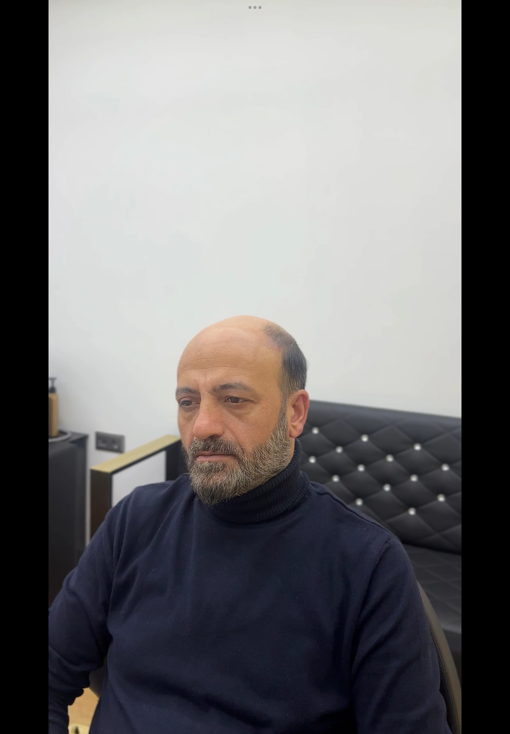 Değişim 19: Öncesi