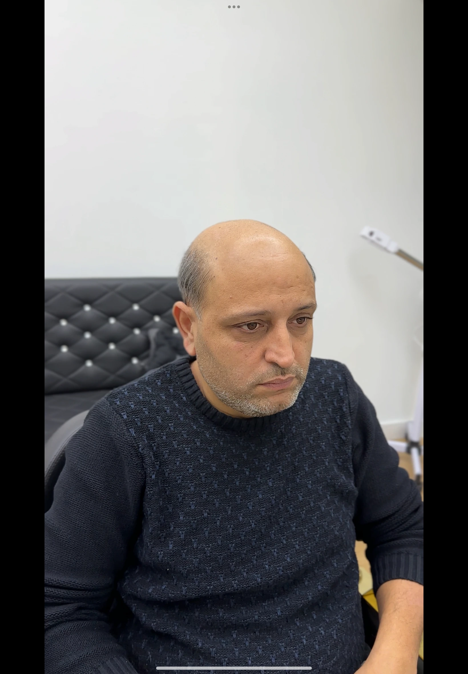 Değişim 36: Öncesi