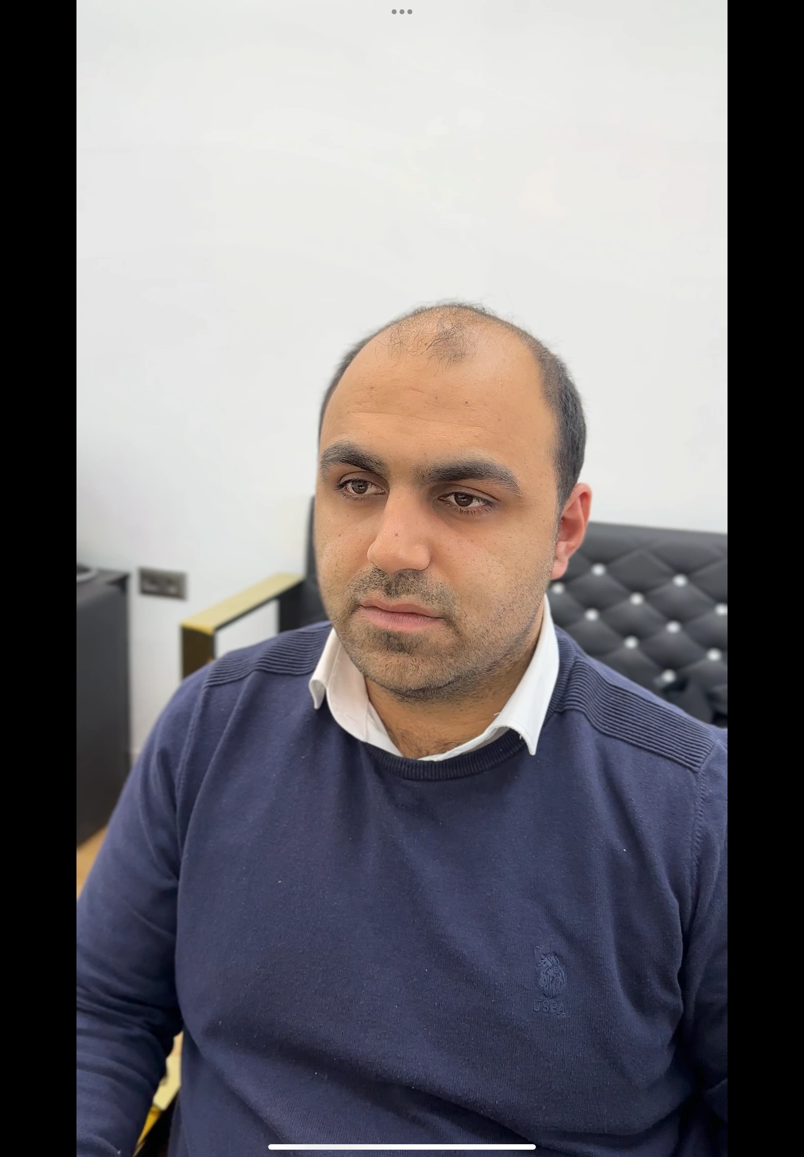 Değişim 40: Öncesi