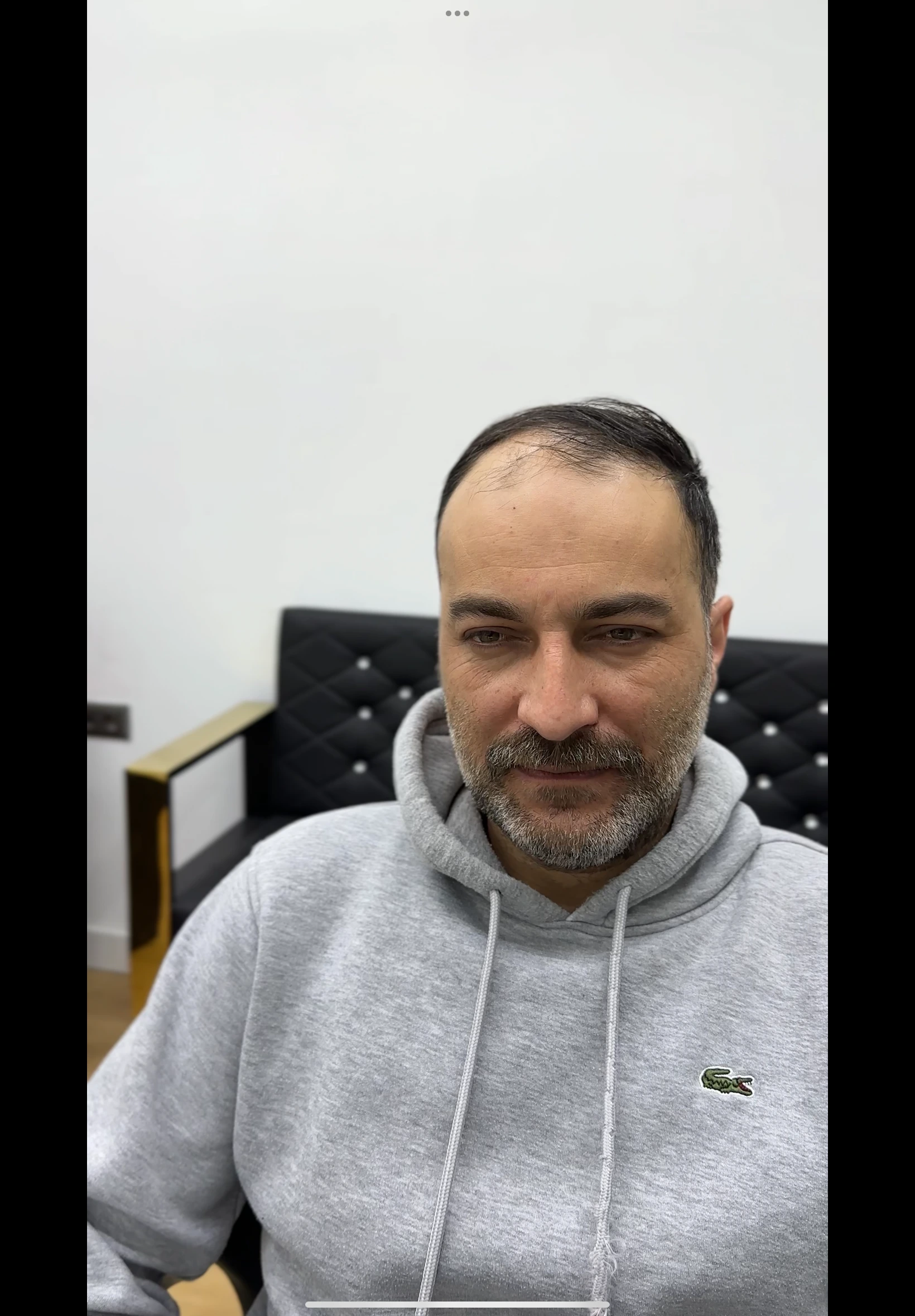 Değişim 41: Öncesi
