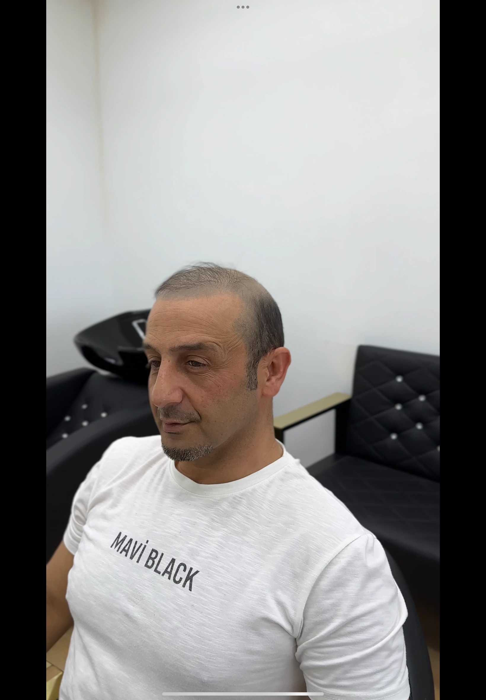 Değişim 45: Öncesi