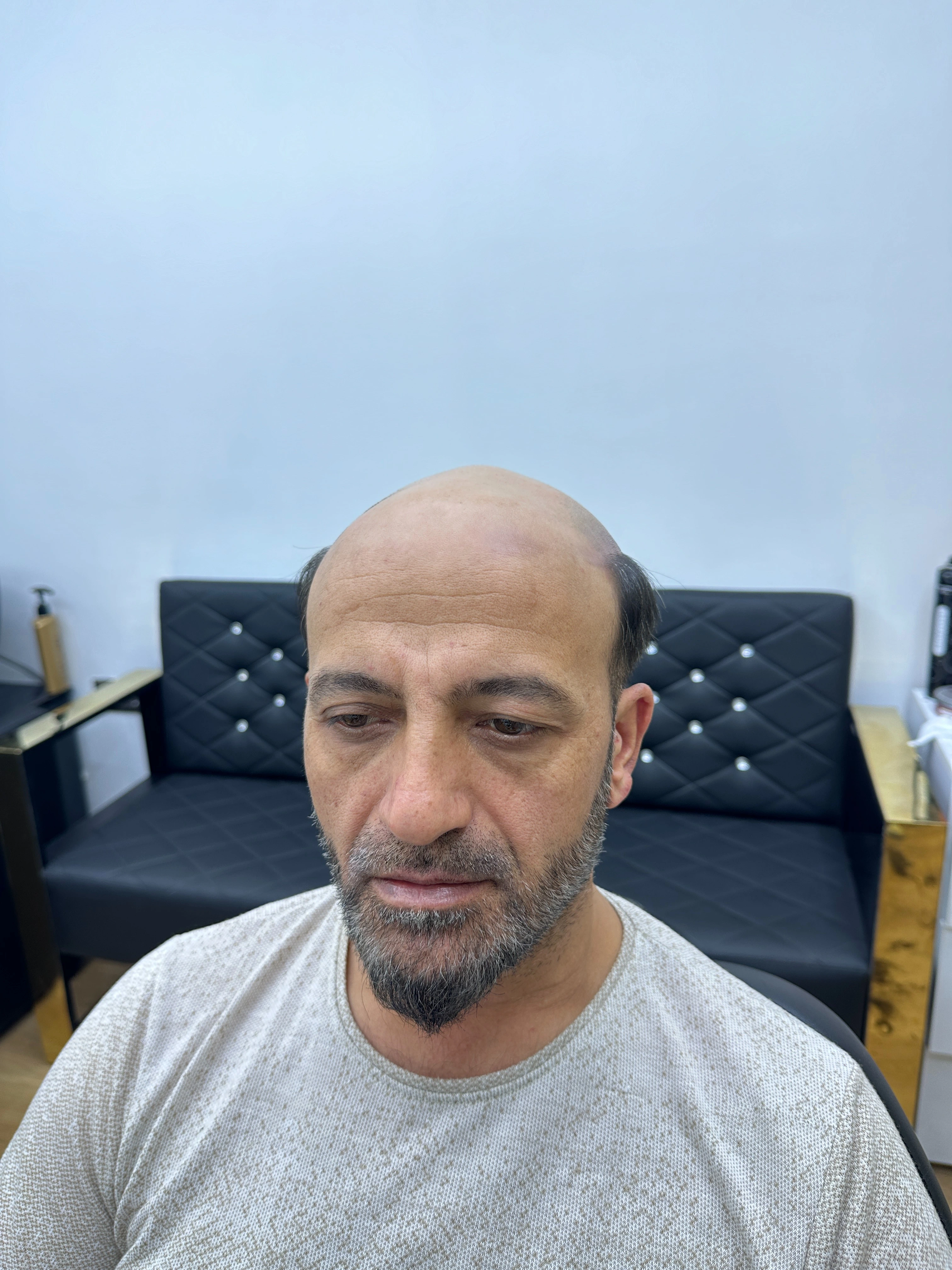 Değişim 55: Öncesi